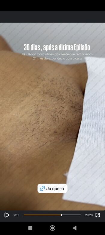 Bronzeamento Natural