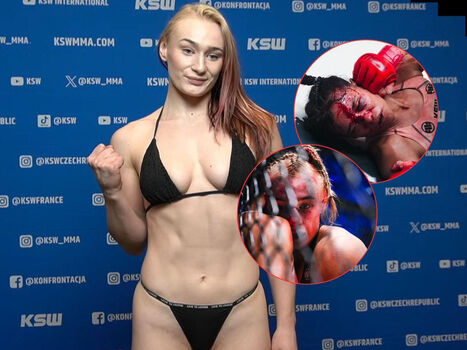 Full leaked Czyewska private onlyfans photo