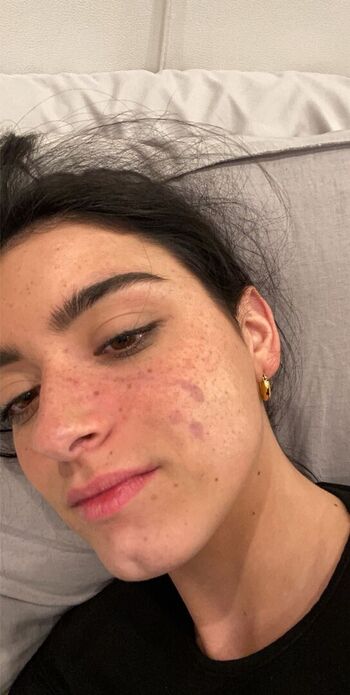 Full leaked Dixie d amelio page private onlyfans photo