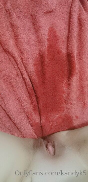 Full leaked Kandyk page private onlyfans photo