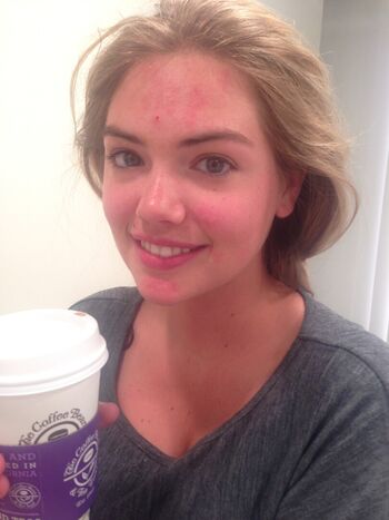 Full leaked Kate upton page private onlyfans photo