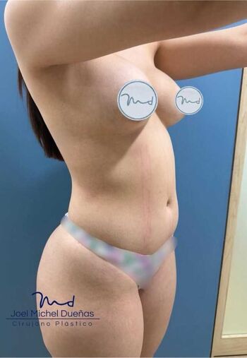 Full leaked Lesli de la torre private onlyfans photo
