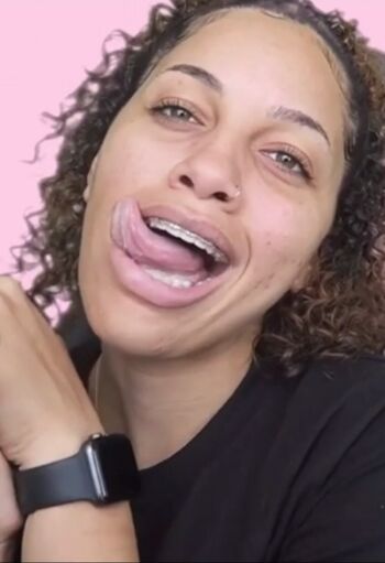 lightskin