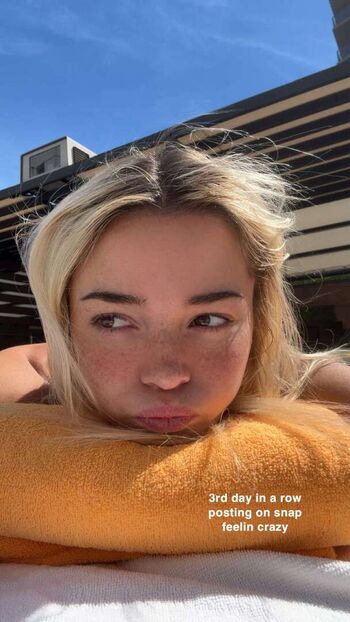 Livvy Dunne