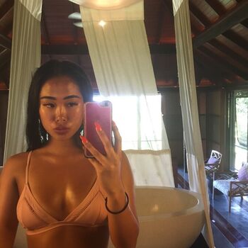 nickjonastillhasdiabetes