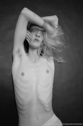 Severeromantic