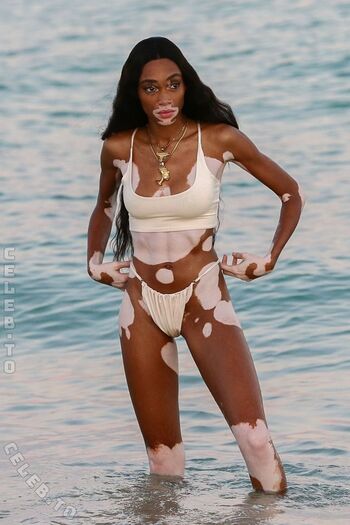 Full leaked Winnie harlow page private onlyfans photo