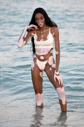 Winnie Harlow