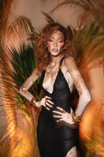 Full leaked Winnie harlow page private onlyfans photo